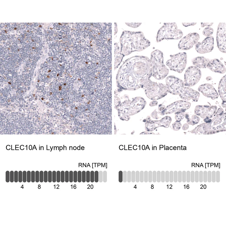 Immunohistochemistry (Formalin/PFA-fixed paraffin-embedded sections) - Anti-CLEC10A Antibody [CL15523] (AB327164)