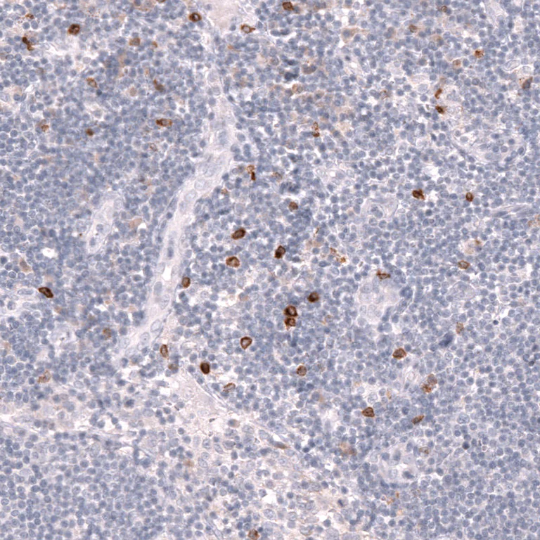 Immunohistochemistry (Formalin/PFA-fixed paraffin-embedded sections) - Anti-CLEC10A Antibody [CL15523] (AB327164)