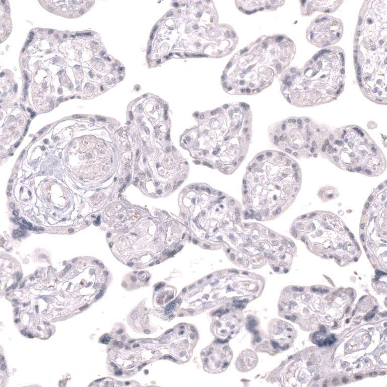 Immunohistochemistry (Formalin/PFA-fixed paraffin-embedded sections) - Anti-CLEC10A Antibody [CL15523] (AB327164)