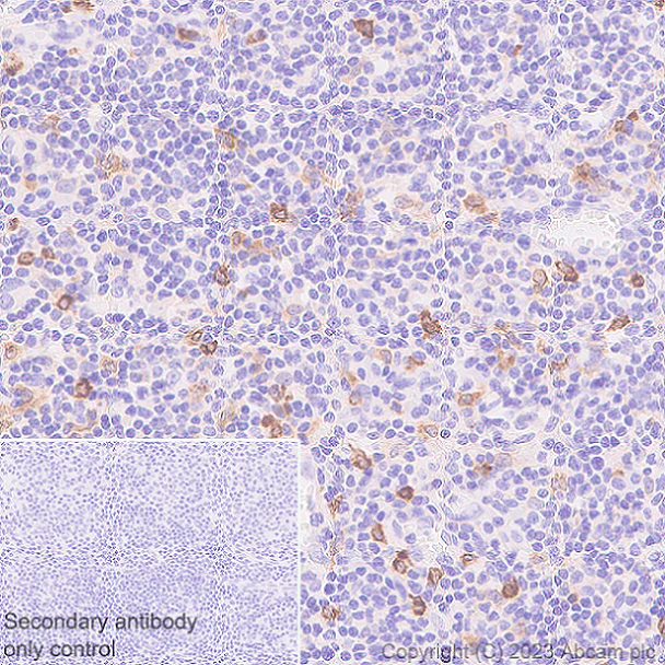 Immunohistochemistry (Formalin/PFA-fixed paraffin-embedded sections) - Anti-CLEC10A antibody [EPR27400-166] (AB315086)