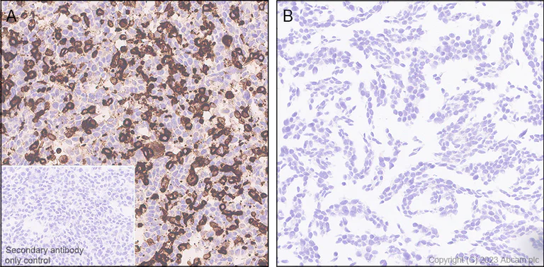 Immunohistochemistry (Formalin/PFA-fixed paraffin-embedded sections) - Anti-CLEC10A antibody [EPR27400-166] (AB315086)