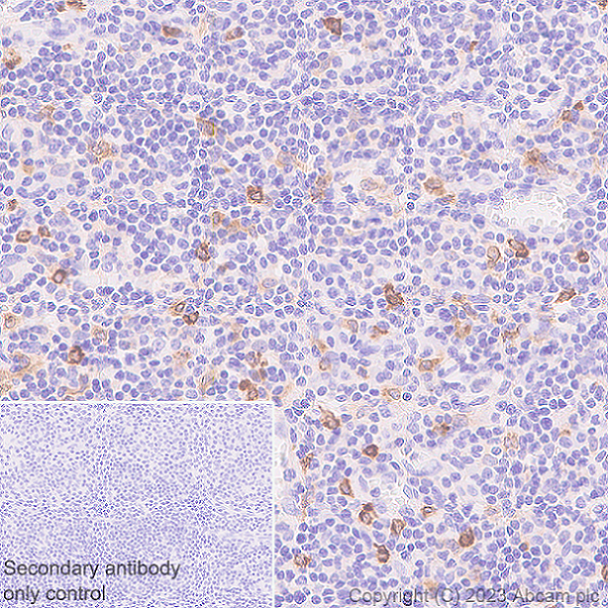 Immunohistochemistry (Formalin/PFA-fixed paraffin-embedded sections) - Anti-CLEC10A antibody [EPR27400-166] - BSA and Azide free (AB315087), expandable thumbnail