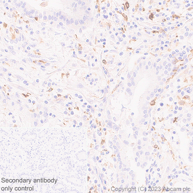 Immunohistochemistry (Formalin/PFA-fixed paraffin-embedded sections) - Anti-CLEC10A antibody [EPR27400-166] - BSA and Azide free (AB315087), expandable thumbnail
