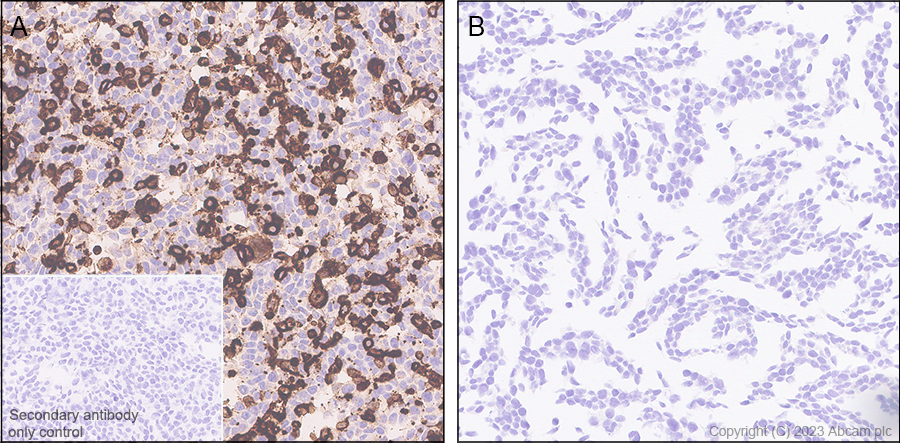 Immunohistochemistry (Formalin/PFA-fixed paraffin-embedded sections) - Anti-CLEC10A antibody [EPR27400-166] - BSA and Azide free (AB315087), expandable thumbnail