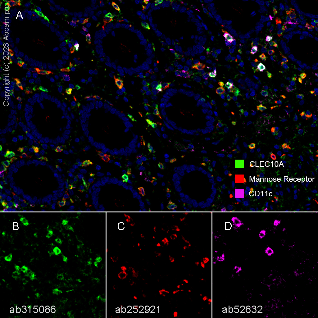 Multiplex immunohistochemistry - Anti-CLEC10A antibody [EPR27400-166] - BSA and Azide free (AB315087), expandable thumbnail