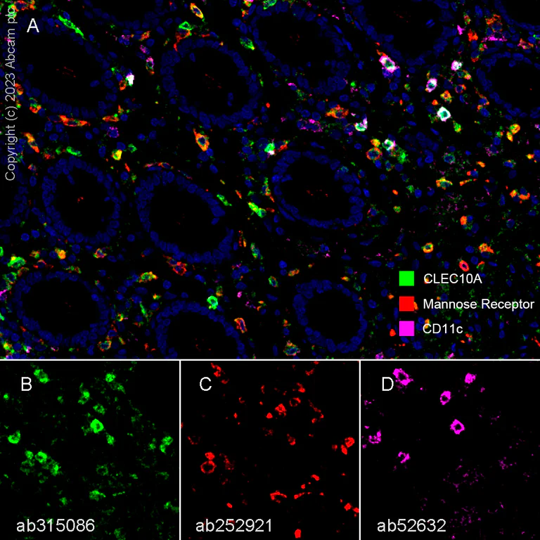 Multiplex immunohistochemistry - Anti-CLEC10A antibody [EPR27400-166] - BSA and Azide free (AB315087)