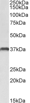 Western blot - Anti-CLEC12A antibody - C-terminal (AB193941)