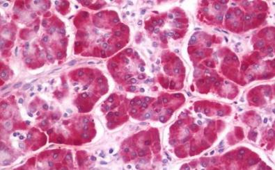 Immunohistochemistry (Formalin/PFA-fixed paraffin-embedded sections) - Anti-CLEC12B antibody (AB211452), expandable thumbnail