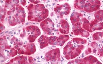 Immunohistochemistry (Formalin/PFA-fixed paraffin-embedded sections) - Anti-CLEC12B antibody (AB211452)