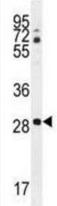 Western blot - Anti-CLEC12B antibody (AB211452), expandable thumbnail