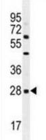 Western blot - Anti-CLEC12B antibody (AB211452), expandable thumbnail
