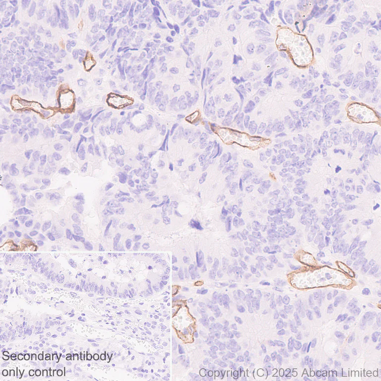 Immunohistochemistry (Formalin/PFA-fixed paraffin-embedded sections) - Anti-CLEC14A antibody [EPR30281-548] (AB324497)