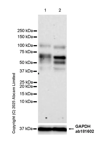 Western blot - Anti-CLEC14A antibody [EPR30281-548] (AB324497)