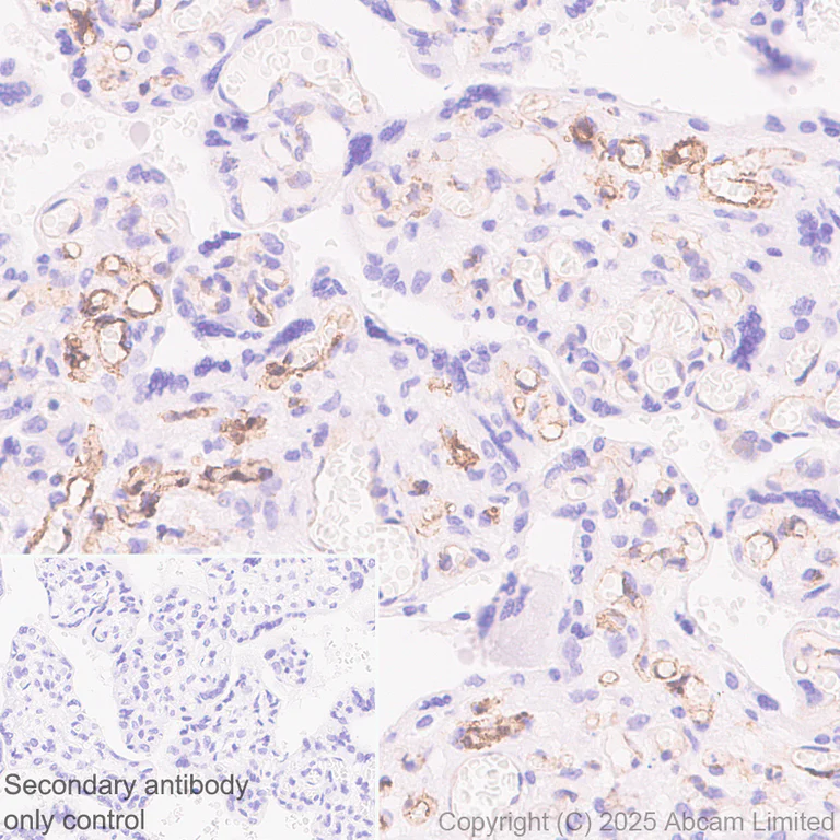 Immunohistochemistry (Formalin/PFA-fixed paraffin-embedded sections) - Anti-CLEC14A antibody [EPR30281-548] - BSA and Azide free (AB324498)