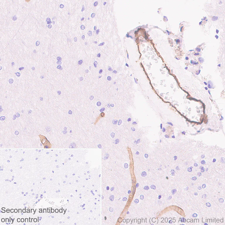 Immunohistochemistry (Formalin/PFA-fixed paraffin-embedded sections) - Anti-CLEC14A antibody [EPR30281-548] - BSA and Azide free (AB324498)