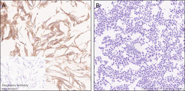 Immunohistochemistry (Formalin/PFA-fixed paraffin-embedded sections) - Anti-CLEC14A antibody [EPR30281-548] - BSA and Azide free (AB324498)