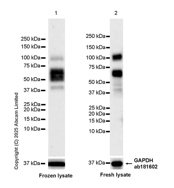 Western blot - Anti-CLEC14A antibody [EPR30281-548] - BSA and Azide free (AB324498)