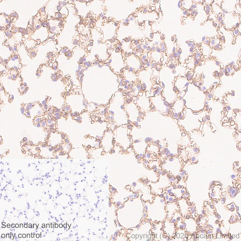 Immunohistochemistry (Formalin/PFA-fixed paraffin-embedded sections) - Anti-CLEC14A antibody [EPR30282-549] (AB326425)