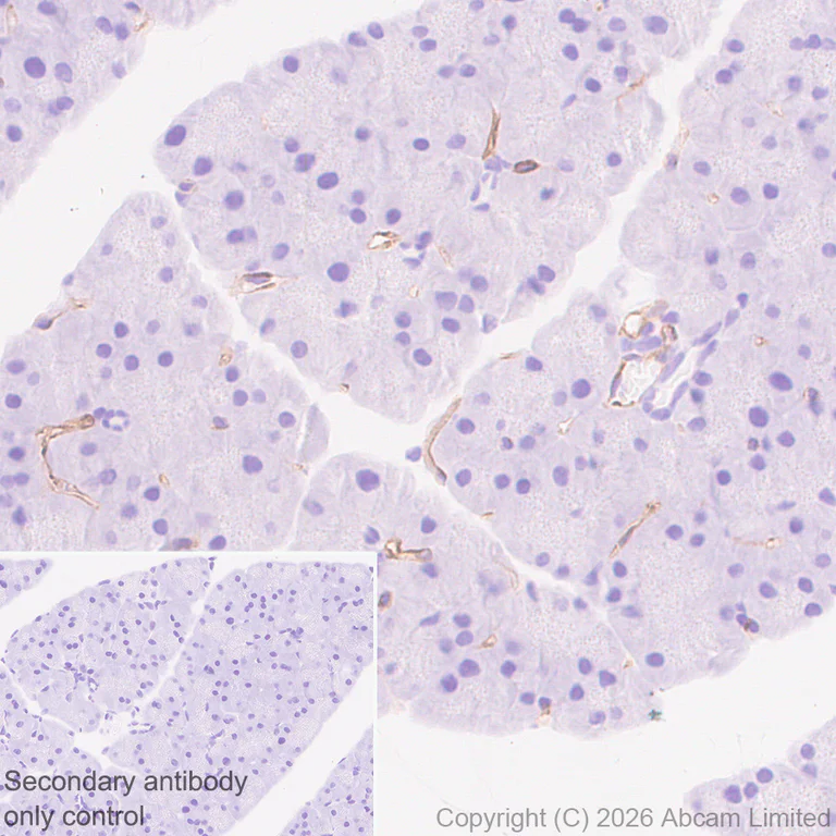 Immunohistochemistry (Formalin/PFA-fixed paraffin-embedded sections) - Anti-CLEC14A antibody [EPR30282-549] (AB326425)