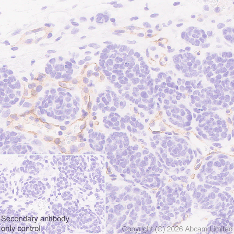 Immunohistochemistry (Formalin/PFA-fixed paraffin-embedded sections) - Anti-CLEC14A antibody [EPR30282-549] - BSA and Azide free (AB326428)
