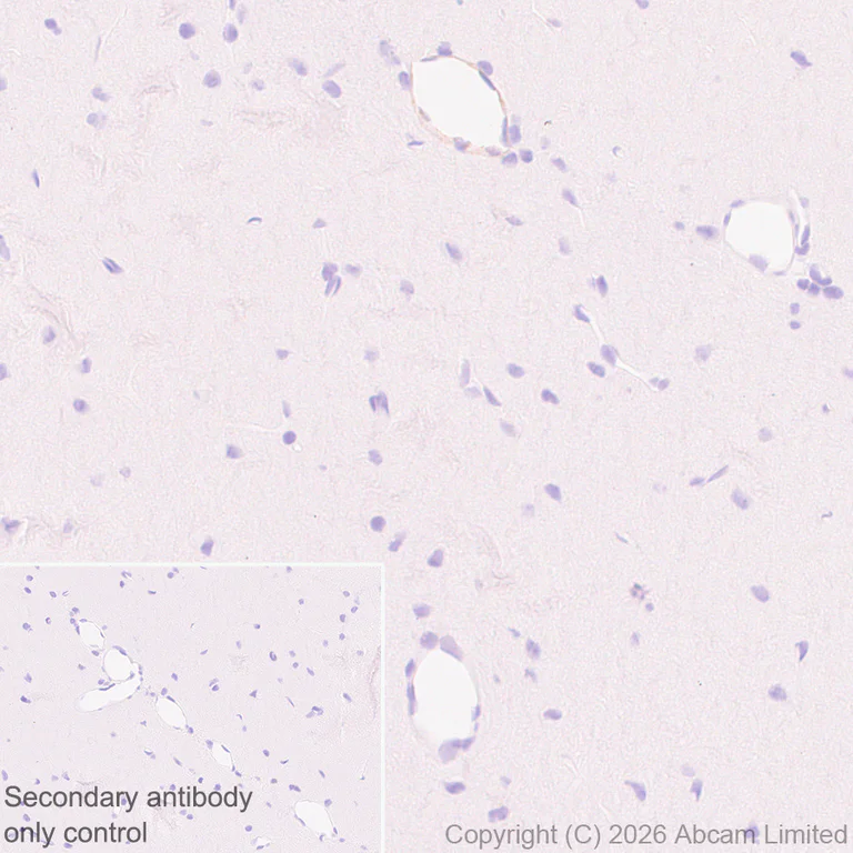 Immunohistochemistry (Formalin/PFA-fixed paraffin-embedded sections) - Anti-CLEC14A antibody [EPR30282-549] - BSA and Azide free (AB326428)