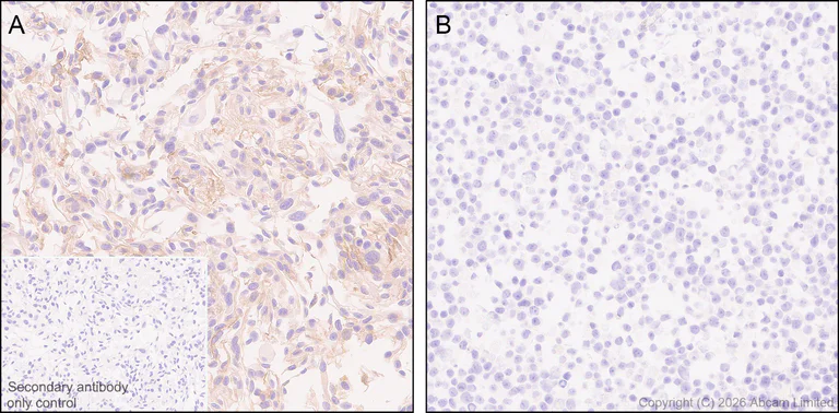 Immunohistochemistry (Formalin/PFA-fixed paraffin-embedded sections) - Anti-CLEC14A antibody [EPR30282-549] - BSA and Azide free (AB326428)