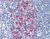 Immunohistochemistry (Formalin/PFA-fixed paraffin-embedded sections) - Anti-CLEC2D antibody (AB111105)