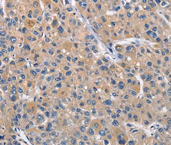 Immunohistochemistry (Formalin/PFA-fixed paraffin-embedded sections) - Anti-CLEC2D antibody (AB197341)
