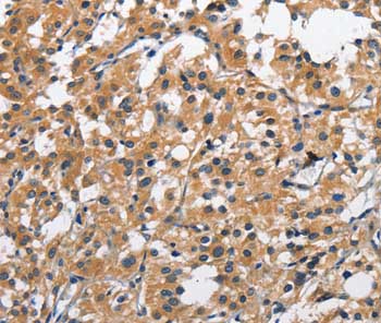 Immunohistochemistry (Formalin/PFA-fixed paraffin-embedded sections) - Anti-CLEC2D antibody (AB197341)