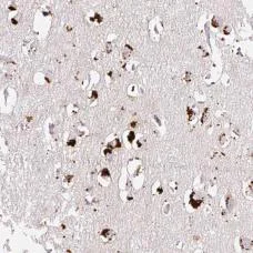 Immunohistochemistry (Formalin/PFA-fixed paraffin-embedded sections) - Anti-CLEC3A antibody (AB185282)