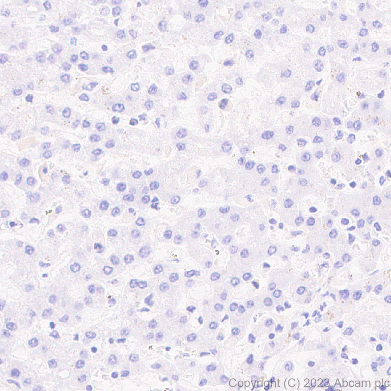 Immunohistochemistry (Formalin/PFA-fixed paraffin-embedded sections) - Anti-CLEC4A antibody [EPR26969-125] - BSA and Azide free (AB315329)