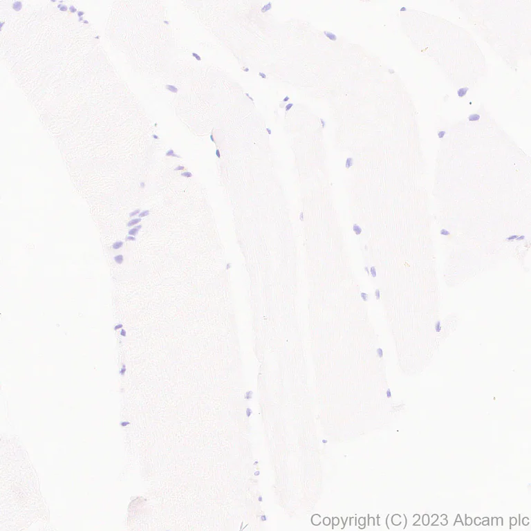 Immunohistochemistry (Formalin/PFA-fixed paraffin-embedded sections) - Anti-CLEC4A antibody [EPR26969-125] - BSA and Azide free (AB315329)
