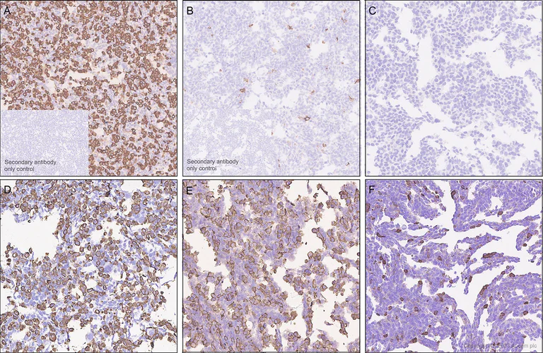 Immunohistochemistry (Formalin/PFA-fixed paraffin-embedded sections) - Anti-CLEC4A antibody [EPR26969-125] - BSA and Azide free (AB315329)