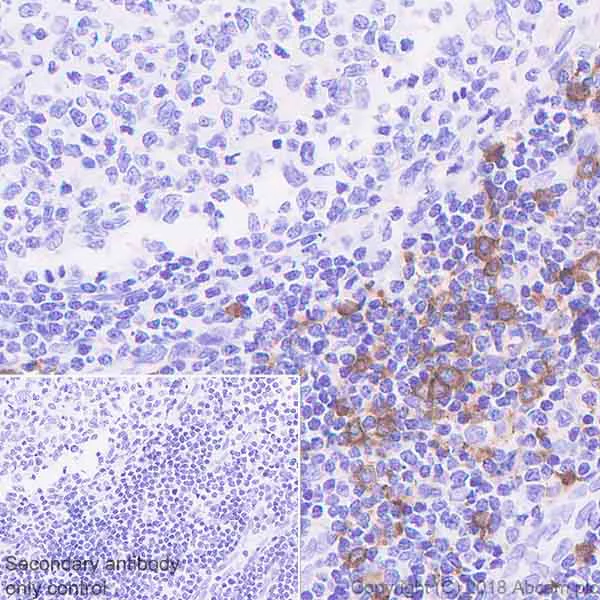 Immunohistochemistry (Formalin/PFA-fixed paraffin-embedded sections) - Anti-CLEC4C antibody [EPR21981] (AB239077)
