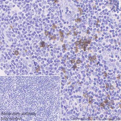 Immunohistochemistry (Formalin/PFA-fixed paraffin-embedded sections) - Anti-CLEC4C antibody [EPR21985] - BSA and Azide free (AB240557)