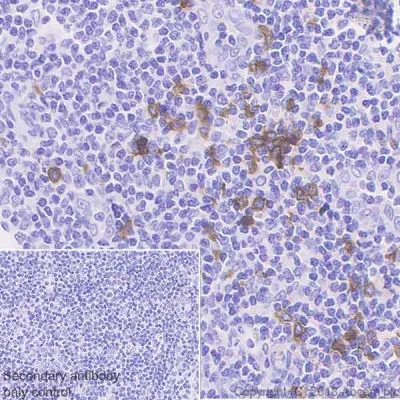 Immunohistochemistry (Formalin/PFA-fixed paraffin-embedded sections) - Anti-CLEC4C antibody [EPR21985] - BSA and Azide free (AB240557)