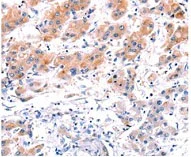 Immunohistochemistry (Formalin/PFA-fixed paraffin-embedded sections) - Anti-CLEC4D antibody (AB175021)