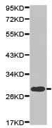 Western blot - Anti-CLEC4D antibody (AB175021), expandable thumbnail