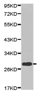 Western blot - Anti-CLEC4D antibody (AB175021)