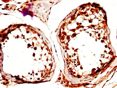 Immunohistochemistry (Formalin/PFA-fixed paraffin-embedded sections) - Anti-CLEC4E/MINCLE antibody (AB236605)