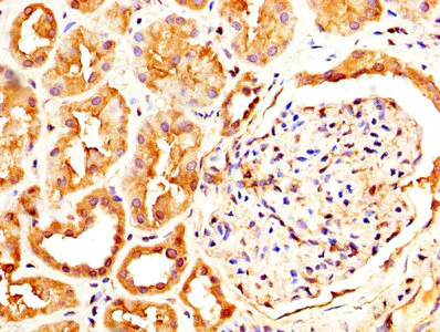 Immunohistochemistry (Formalin/PFA-fixed paraffin-embedded sections) - Anti-CLEC4E/MINCLE antibody (AB236605)