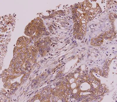 Immunohistochemistry (Formalin/PFA-fixed paraffin-embedded sections) - Anti-CLEC4E/MINCLE antibody [AT16E3] (AB100846)