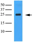Western blot - Anti-CLEC4E/MINCLE antibody [AT16E3] (AB100846)