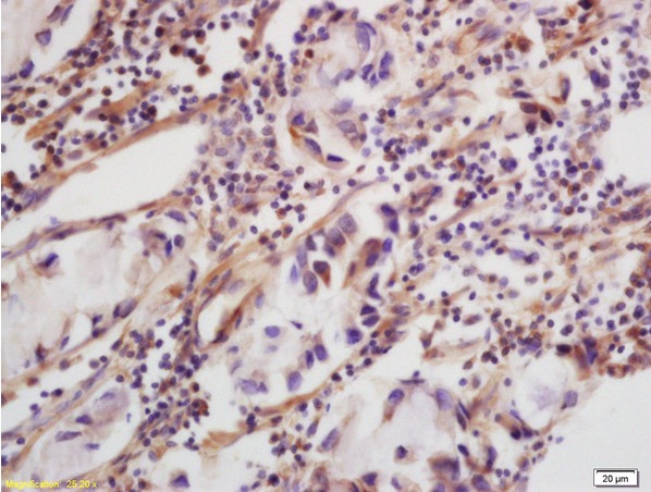 Immunohistochemistry (Formalin/PFA-fixed paraffin-embedded sections) - Anti-CLEC5A antibody (AB203200)