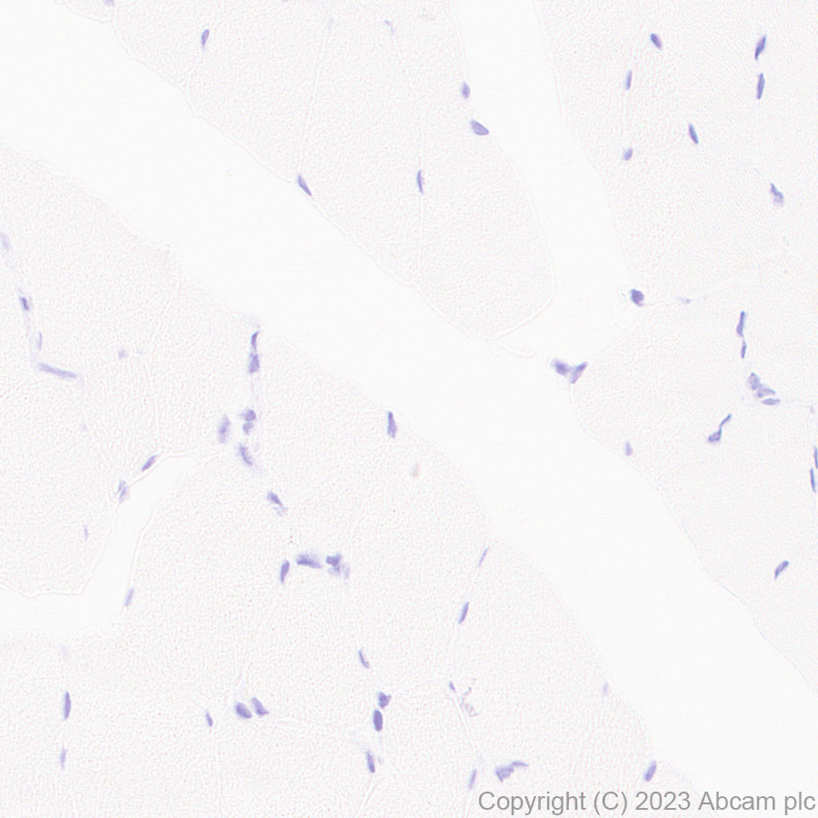 Immunohistochemistry (Formalin/PFA-fixed paraffin-embedded sections) - Anti-CLEC5A antibody [EPR28104-85] (AB313337)