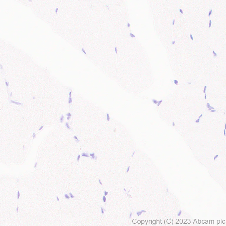 Immunohistochemistry (Formalin/PFA-fixed paraffin-embedded sections) - Anti-CLEC5A antibody [EPR28104-85] (AB313337)