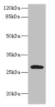 Western blot - Anti-CLEC9A antibody (AB222794)