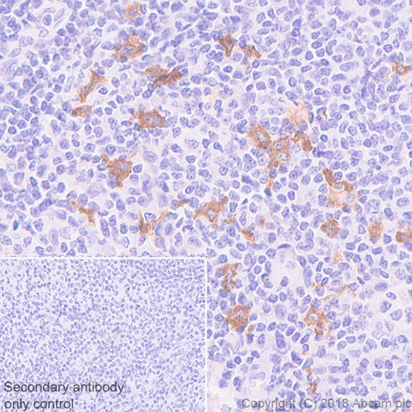 Immunohistochemistry (Formalin/PFA-fixed paraffin-embedded sections) - Anti-CLEC9A antibody [EPR22324] (AB223188), expandable thumbnail