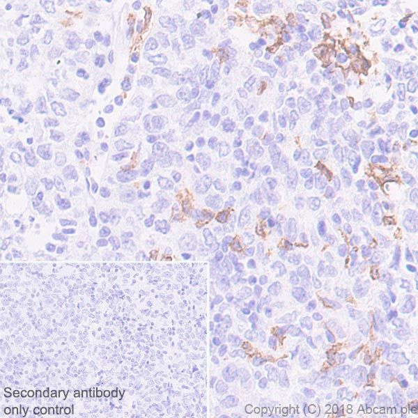Immunohistochemistry (Formalin/PFA-fixed paraffin-embedded sections) - Anti-CLEC9A antibody [EPR22324] (AB223188), expandable thumbnail