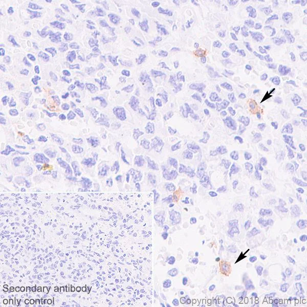 Immunohistochemistry (Formalin/PFA-fixed paraffin-embedded sections) - Anti-CLEC9A antibody [EPR22324] - BSA and Azide free (AB245121)
